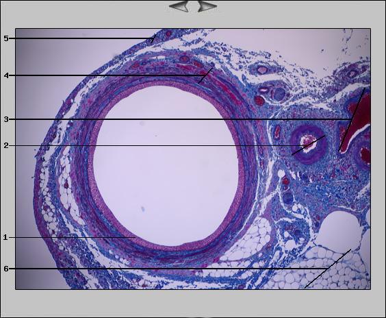 Ureter, 5x