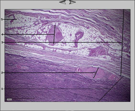Aorta, 5x I