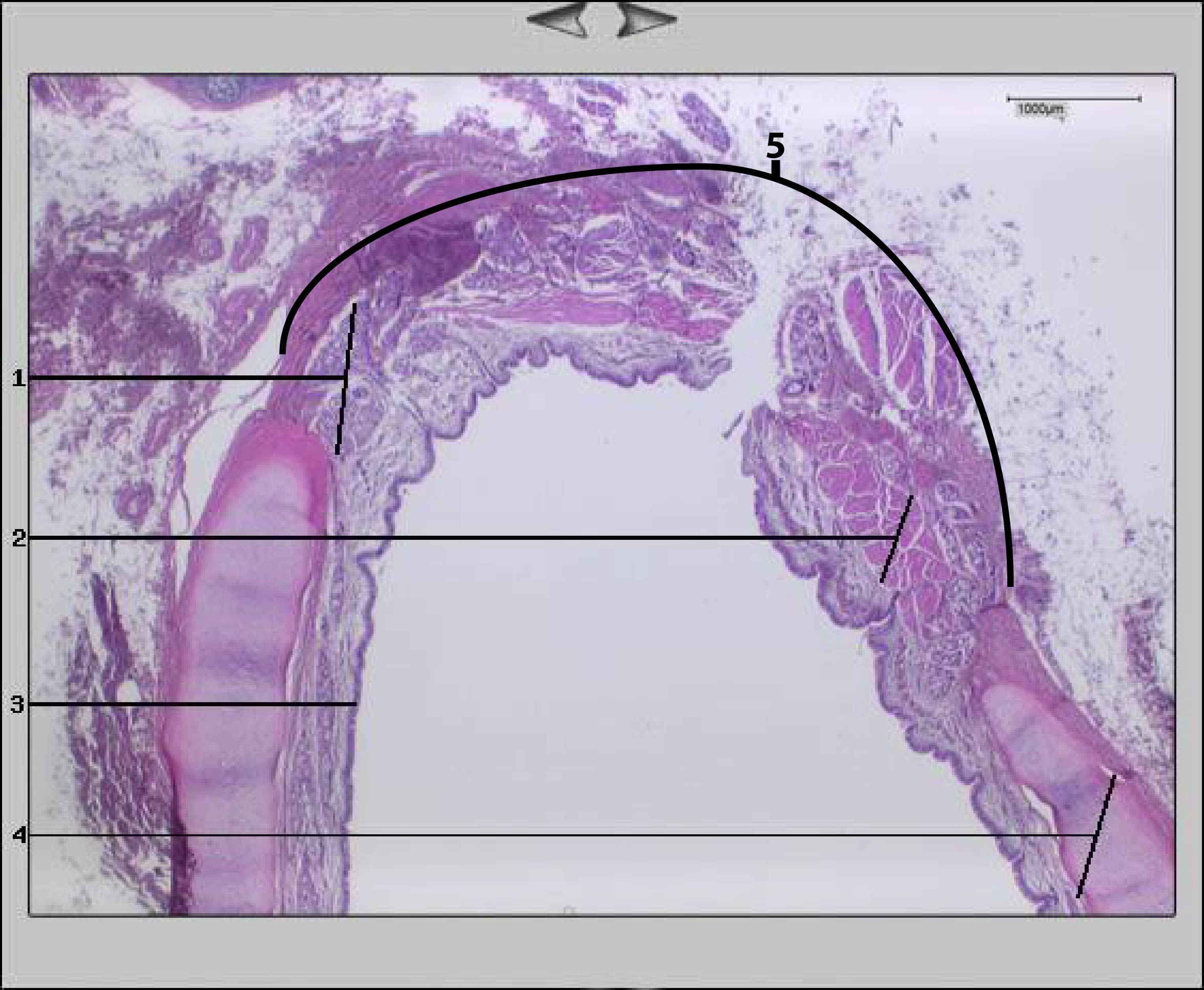 1,25x <br> Paries membranaceus