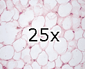 245