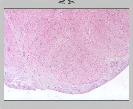 Fundus, 10x III