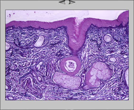 Ohrmuschel Epithel, 20x III