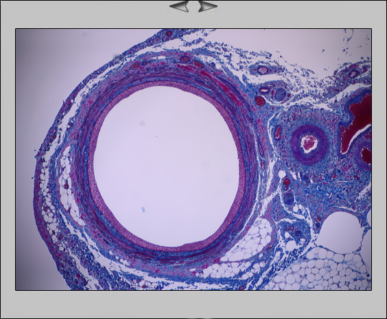 Ureter, 5x