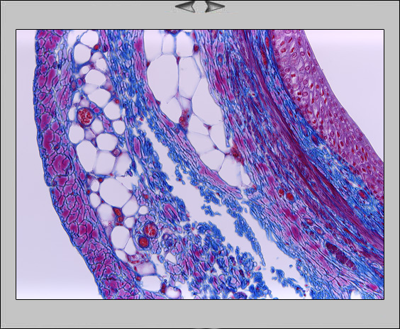 Ureter, 20x