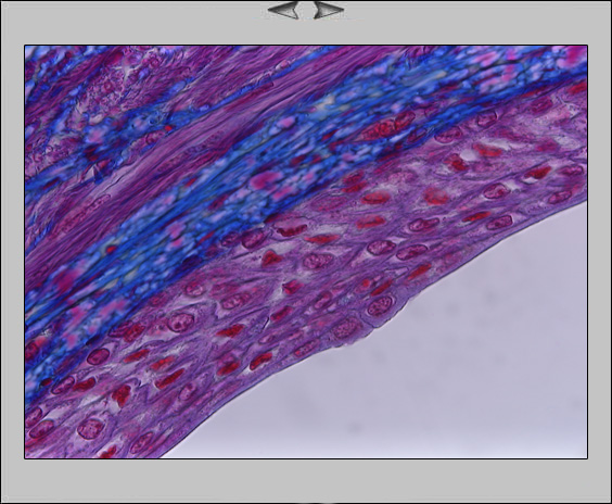 Ureter, 63x