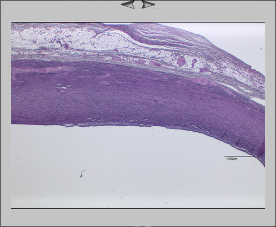 Aorta, 1,25x