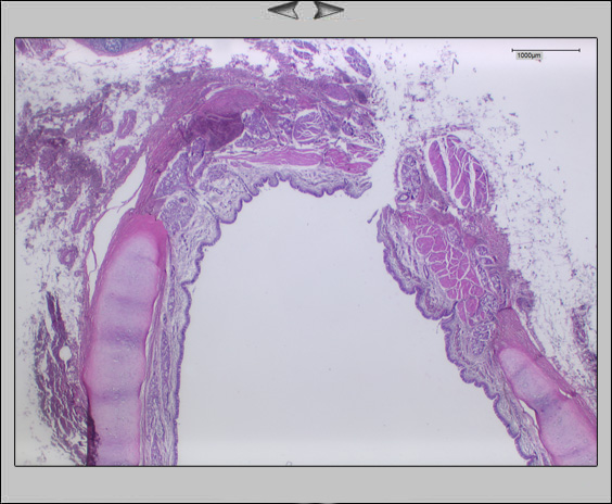 1,25x <br> Paries membranaceus
