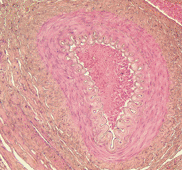 Arterie (muskulärer Typ) 10x