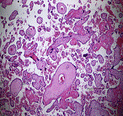 Placenta (reif)