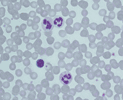 Neutrophiler Granulozyt, 100x