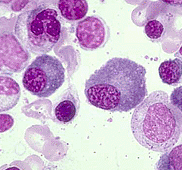 Erythroblast, 100x