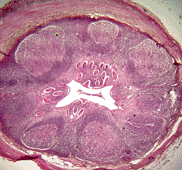 Processus vermiformis quer