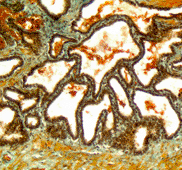 Glandula vesiculosa