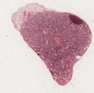 Thyreoidea