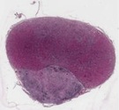 Hypophyse