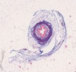 Übergangsepithel, Ureter