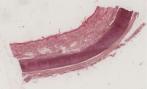 elastischer Knorpel