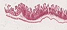 Ileum längs,